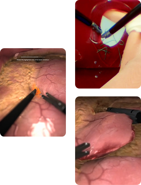 Trzy zrzuty ekranu z różnych procedur chirurgicznych - dwóch wirtualnych i jednej fizycznej.