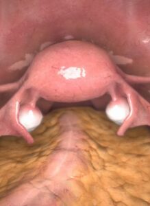 Zrzut ekranu treningu histerektomii w wirtualnej rzeczywistości.